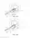 Fig. 22 - Suturing device for minimally invasive surgery and needles and methods thereof