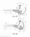 Fig. 49 - Suturing device for minimally invasive surgery and needles and methods thereof