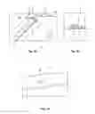 Fig. 12 - Surgical staples and end effectors for deploying the same