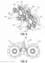 Fig. 06 - Controlling a size of a pyloris
