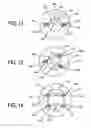 Fig. 10 - Controlling a size of a pyloris