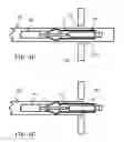 Fig. 06 - Deploying and fixating an implant across an organ wall