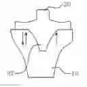 Fig. 01 - Resection guide, trial knee joint implant, and surgical instrument for knee arthroplasty