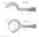 Fig. 21 - Circular bone tunneling device employing a stabilizing element