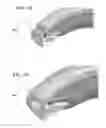 Fig. 40 - Circular bone tunneling device employing a stabilizing element