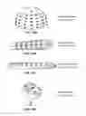 Fig. 16 - System and method for preparing prosthetic hip implantation