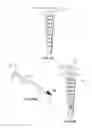 Fig. 18 - System and method for preparing prosthetic hip implantation