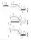 Fig. 20 - System and method for preparing prosthetic hip implantation