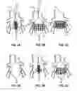 Fig. 03 - Devices and Methods for Improving Transcatheter Aortic Valve Implantation