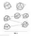 Fig. 04 - Devices and Methods for Improving Transcatheter Aortic Valve Implantation