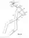 Fig. 12 - Devices and Methods for Improving Transcatheter Aortic Valve Implantation