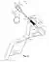 Fig. 15 - Devices and Methods for Improving Transcatheter Aortic Valve Implantation