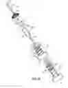 Fig. 22 - Devices and Methods for Improving Transcatheter Aortic Valve Implantation