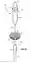 Fig. 24 - Devices and Methods for Improving Transcatheter Aortic Valve Implantation