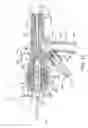 Fig. 13 - Thrombectomy catheter