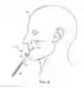 Fig. 08 - Lifting surgical instrument having branch point