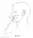 Fig. 09 - Lifting surgical instrument having branch point