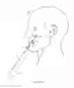 Fig. 11 - Lifting surgical instrument having branch point