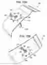 Fig. 21 - Devices and methods for providing surgical access