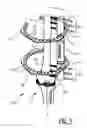 Fig. 02 - Coupling device for in an orthopaedic system