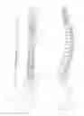 Fig. 02 - FLUID-POWERED ELONGATION INSTRUMENTATION FOR CORRECTING ORTHOPEDIC DEFORMITIES