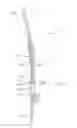 Fig. 17 - FLUID-POWERED ELONGATION INSTRUMENTATION FOR CORRECTING ORTHOPEDIC DEFORMITIES