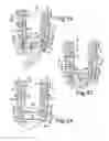 Fig. 10 - Bone anchor receiver with longitudinally extending tool attachment structures