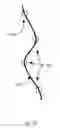 Fig. 11 - Surgical rod bending system and method