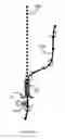 Fig. 16 - Surgical rod bending system and method
