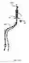 Fig. 25 - Surgical rod bending system and method