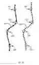 Fig. 29 - Surgical rod bending system and method