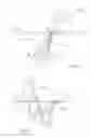 Fig. 07 - Instrument For Therapeutically Cytotoxically Ablating Parathyroidal Tissue Within A Parathyroid Gland