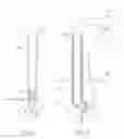 Fig. 09 - Instrument For Therapeutically Cytotoxically Ablating Parathyroidal Tissue Within A Parathyroid Gland