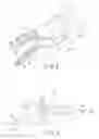Fig. 03 - Medical member and medical device