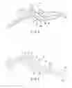 Fig. 04 - Medical member and medical device