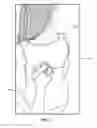 Fig. 04 - DEVICE AND METHOD FOR CHEST PHYSIOTHERAPY TREATMENT