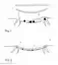 Fig. 02 - WOUND TREATMENT THERAPY