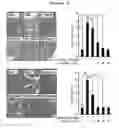 Fig. 06 - COMPOSITION FOR PREVENTING AND TREATING PANCREATITIS CONTAINING NAPHTHOQUINONE-BASED COMPOUND AS ACTIVE INGREDIENT