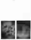 Fig. 06 - Fluorouracil glycolate compound for the treatment of warts, molluscum contagiosum