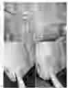 Fig. 08 - Fluorouracil glycolate compound for the treatment of warts, molluscum contagiosum