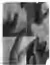 Fig. 14 - Fluorouracil glycolate compound for the treatment of warts, molluscum contagiosum