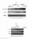 Fig. 04 - Histone deacetylase inhibitor, and preparation method and use thereof