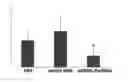 Fig. 01 - THERAPEUTIC AGENT FOR EYE DISEASE