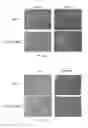 Fig. 09 - USE OF ALGINATE COMPOSITIONS IN PREVENTING OR REDUCING LIVER DAMAGE CAUSED BY A HEPATOTOXIC AGENT