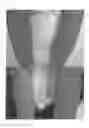 Fig. 02 - Method for treating dermatitis and improving skin texture using B-type natriuretic peptides