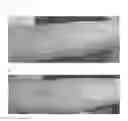 Fig. 04 - Method for treating dermatitis and improving skin texture using B-type natriuretic peptides