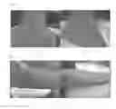 Fig. 07 - Method for treating dermatitis and improving skin texture using B-type natriuretic peptides