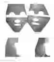 Fig. 08 - Method for treating dermatitis and improving skin texture using B-type natriuretic peptides