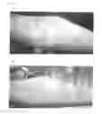 Fig. 10 - Method for treating dermatitis and improving skin texture using B-type natriuretic peptides