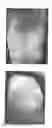 Fig. 15 - Method for treating dermatitis and improving skin texture using B-type natriuretic peptides